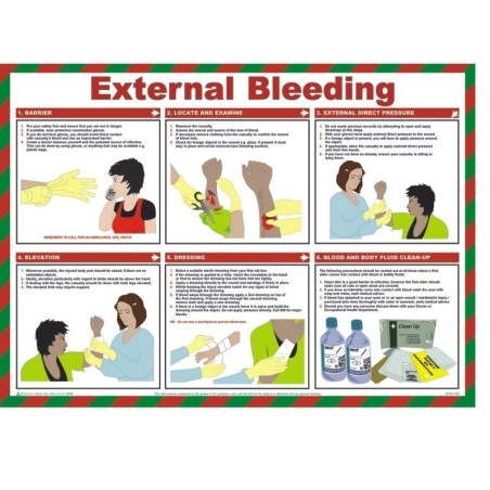 External Bleeding Poster